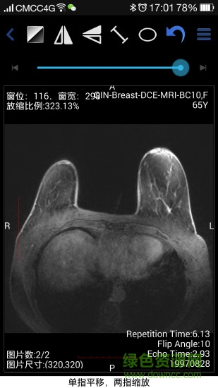 医疗app